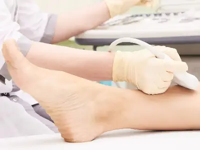 Varicose vein sonography in Nashik - Dr. Dipti Deore